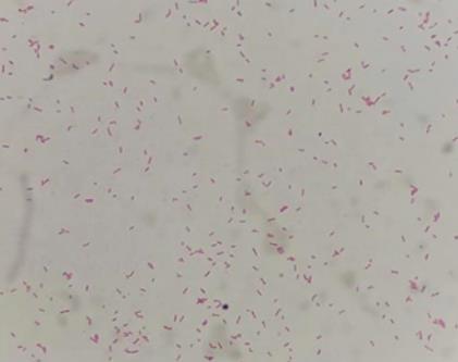 细菌血培养阳性、阴性结果报告解读