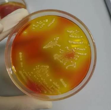 沙门氏菌生长曲线的测定、来源及分离纯化