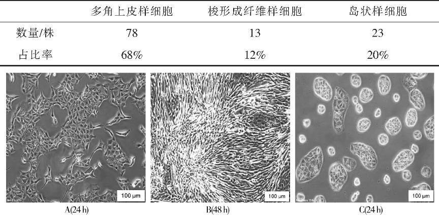 MDCK单克隆细胞复苏活率、生长状态、生长速度和生长形态研究