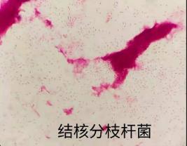 结核分枝杆菌的生物学特性、培养方法及应用