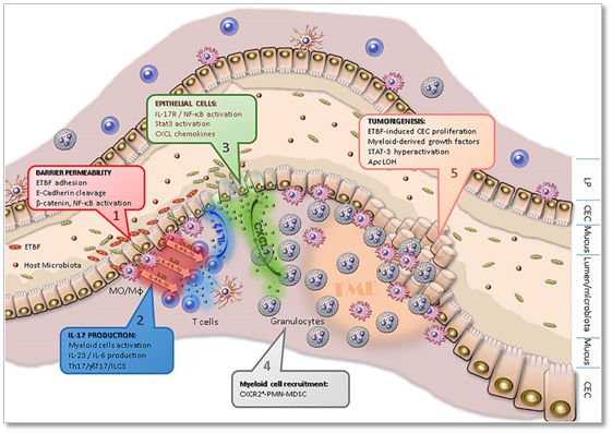 肠道细菌大肠杆菌与脆弱类杆菌联合，或能导致结直肠癌症发生