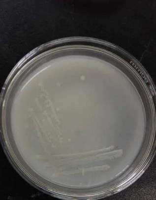 解磷菌是什么菌？解磷微生物种类及分布