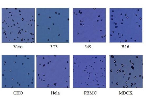 ?典型的传统细菌计数方法两大不足之处