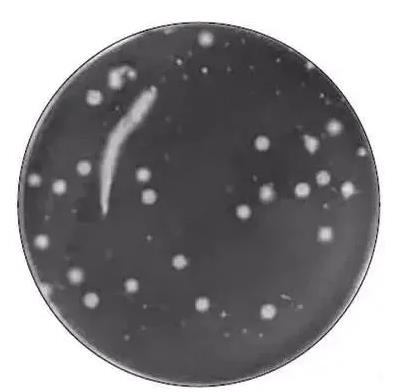 ?菌落计数仪的计数和培养步骤、稀释标准及注意事项