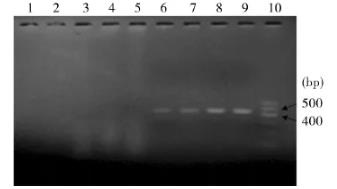 广西牛肺炎支原体病原的分离和鉴定、药敏实验分析（下）