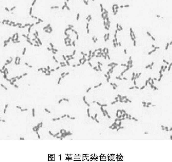 猪链球菌对34种常用药物的敏感性检测【药敏实验】