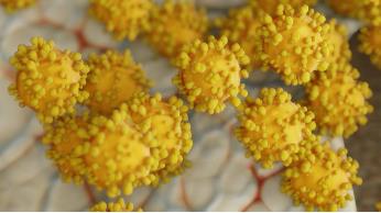 反刍动物瘤胃菌群组成和数量、影响因素及与代谢性疾病关系