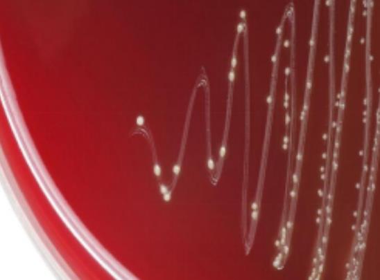 乙型溶血性链球菌来源、分类及检测与诊断【百科知识】