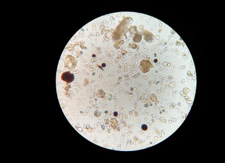 ?土壤中有哪些微生物？土壤微生物在生态系统中的作用