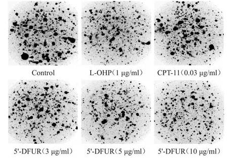胶滴肿瘤药敏检测技术检测及评价不同药物浓度的5'-DFUR对胃癌的疗效（二）