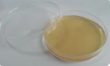 什么是不可培养微生物？原因是什么