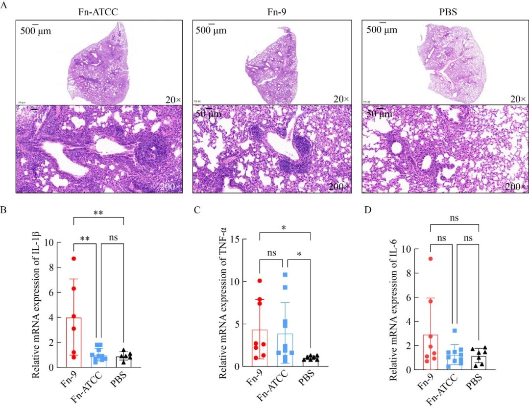 基于细菌生长曲线测定探究具核梭杆菌促进肺癌发展的潜在机制（一）