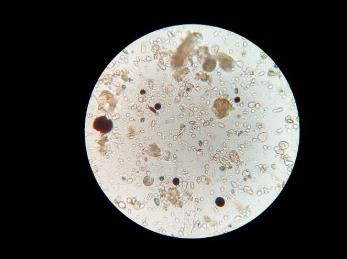 快速药敏检测技术方法、原理、临床转化需求（一）