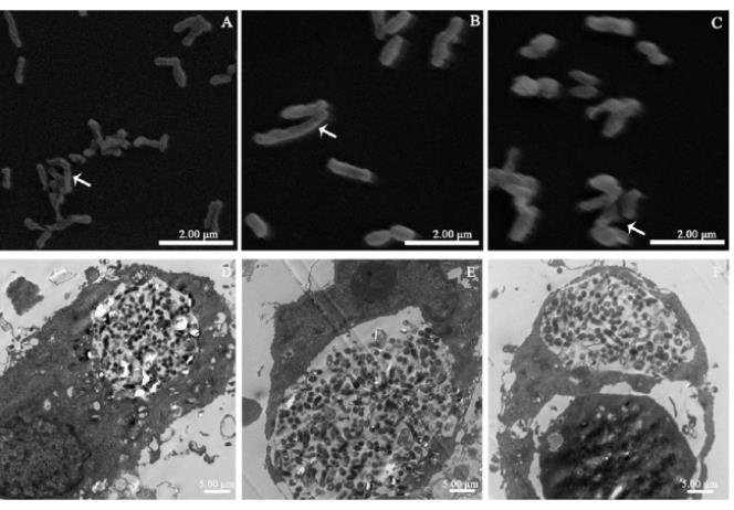 贝氏柯克斯体在高渗脱水环境中的生物学特性研究（三）