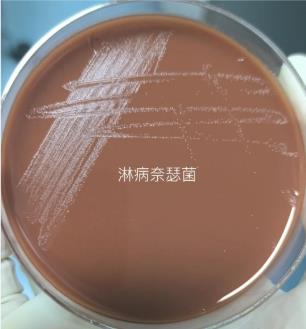 不同保存条件、培养基对淋病奈瑟菌存活率的影响——结果、讨论