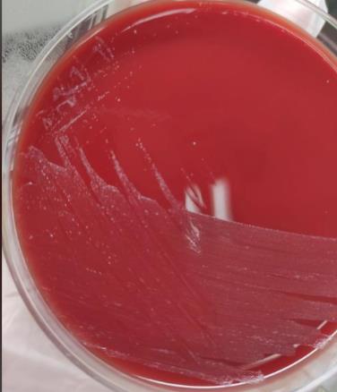 不同保存条件、培养基对淋病奈瑟菌存活率的影响——摘要、材料与方法