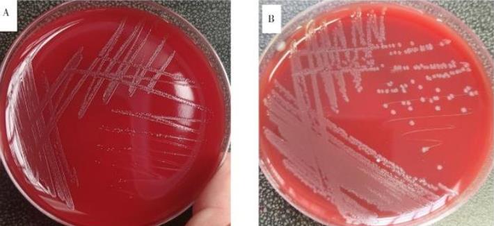 丹毒败血症:猪红斑丹毒丝菌形态、生化特征、鉴定及药敏试验——结果、讨论