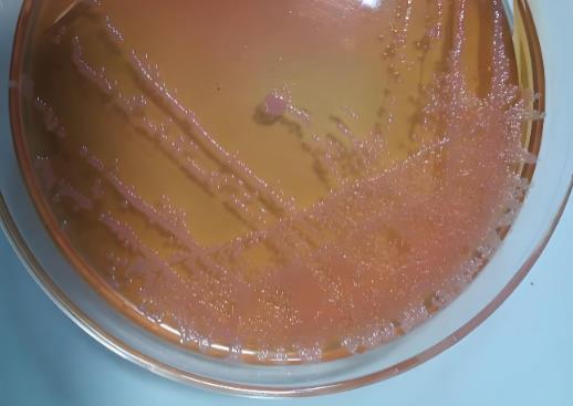 高通量药敏检测指导儿童急性白血病个体化治疗的初步探索——结果