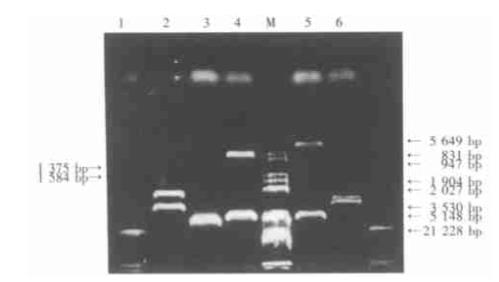 芳香化酶细胞色素P450对胶质瘤细胞生长曲线、细胞周期及分化的作用（上）